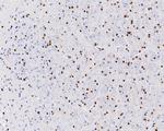 SOX10 Antibody in Immunohistochemistry (Paraffin) (IHC (P))