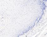 SOX10 Antibody in Immunohistochemistry (Paraffin) (IHC (P))