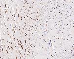 SOX10 Antibody in Immunohistochemistry (Paraffin) (IHC (P))