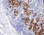 SOX10 Antibody in Immunohistochemistry (Paraffin) (IHC (P))