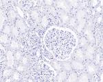 SOX10 Antibody in Immunohistochemistry (Paraffin) (IHC (P))