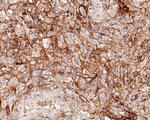 B7-H3 Antibody in Immunohistochemistry (Paraffin) (IHC (P))