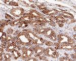 B7-H3 Antibody in Immunohistochemistry (Paraffin) (IHC (P))