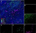 SSEA1 Antibody in Immunohistochemistry (Paraffin) (IHC (P))