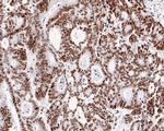 H4K8ac Antibody in Immunohistochemistry (Paraffin) (IHC (P))