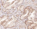 WDR77 Antibody in Immunohistochemistry (Paraffin) (IHC (P))