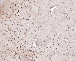 WDR77 Antibody in Immunohistochemistry (Paraffin) (IHC (P))