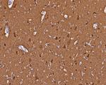 VSNL1 Antibody in Immunohistochemistry (Paraffin) (IHC (P))