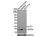 VSNL1 Antibody in Western Blot (WB)