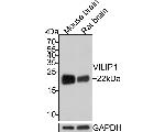 VSNL1 Antibody in Western Blot (WB)