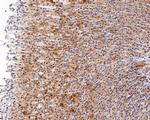 PSME2 Antibody in Immunohistochemistry (Paraffin) (IHC (P))