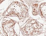 PSMC6 Antibody in Immunohistochemistry (Paraffin) (IHC (P))