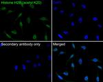 H2BK20ac Antibody in Immunocytochemistry (ICC/IF)