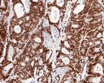 H2BK20ac Antibody in Immunohistochemistry (Paraffin) (IHC (P))