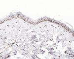 H2BK20ac Antibody in Immunohistochemistry (Paraffin) (IHC (P))