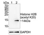 H2BK20ac Antibody in Western Blot (WB)