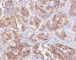 c-Met Antibody in Immunohistochemistry (Paraffin) (IHC (P))