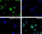 PPP3CB Antibody in Immunocytochemistry (ICC/IF)