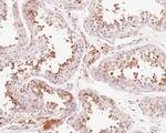 RNF146 Antibody in Immunohistochemistry (Paraffin) (IHC (P))