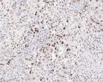 Menin Antibody in Immunohistochemistry (Paraffin) (IHC (P))