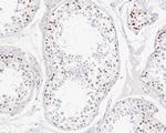 Menin Antibody in Immunohistochemistry (Paraffin) (IHC (P))