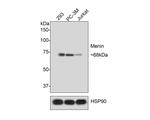 Menin Antibody in Western Blot (WB)