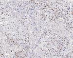 ZEB1 Antibody in Immunohistochemistry (Paraffin) (IHC (P))