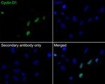 Cyclin D1 Antibody in Immunocytochemistry (ICC/IF)