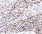 Cyclin D1 Antibody in Immunohistochemistry (Paraffin) (IHC (P))