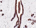 BAX Antibody in Immunohistochemistry (Paraffin) (IHC (P))