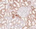 BAX Antibody in Immunohistochemistry (Paraffin) (IHC (P))