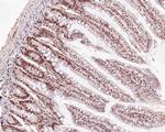 MLH1 Antibody in Immunohistochemistry (Paraffin) (IHC (P))