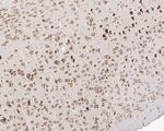 GABBR1 Antibody in Immunohistochemistry (Paraffin) (IHC (P))