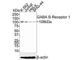 GABBR1 Antibody in Western Blot (WB)