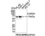 CARD9 Antibody in Western Blot (WB)