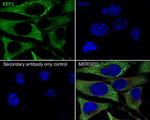 EEF2 Antibody in Immunocytochemistry (ICC/IF)