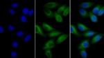 beta Tubulin Antibody in Immunocytochemistry (ICC/IF)