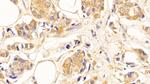 beta Tubulin Antibody in Immunohistochemistry (Paraffin) (IHC (P))