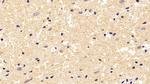 beta Tubulin Antibody in Immunohistochemistry (Paraffin) (IHC (P))