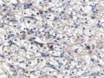 S100A8 Antibody in Immunohistochemistry (Paraffin) (IHC (P))