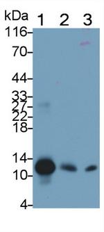 S100A8 Antibody in Western Blot (WB)