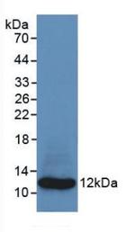 S100A8 Antibody in Western Blot (WB)