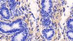 COL1A1 Antibody in Immunohistochemistry (Paraffin) (IHC (P))