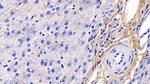 COL1A1 Antibody in Immunohistochemistry (Paraffin) (IHC (P))