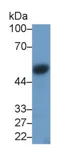 VEGFC Antibody in Western Blot (WB)