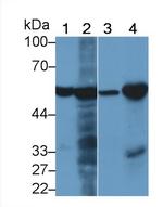 PAH Antibody in Western Blot (WB)