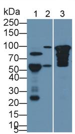 COMP Antibody in Western Blot (WB)