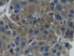 Haptoglobin Antibody in Immunohistochemistry (Paraffin) (IHC (P))