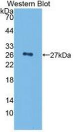 Complement Factor H Antibody in Western Blot (WB)