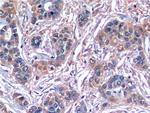 SERPINB3 Antibody in Immunohistochemistry (Paraffin) (IHC (P))